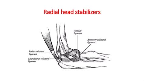 Pediatric Radial head dislocation | PPTX