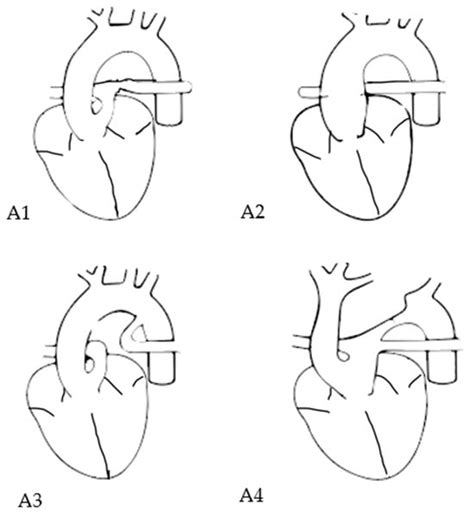 Prenatal Diagnosis, Course and Outcome of Patients with Truncus ...