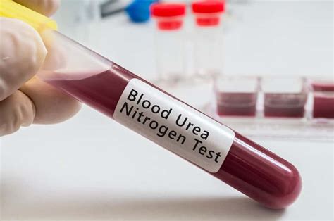 Blood Urea Nitrogen Test : ब्लड यूरिया नाइट्रोजन टेस्ट है? प्रक्रिया ...