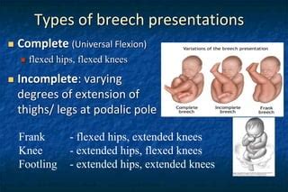 Image result for How to Implement Linear Regression in Python