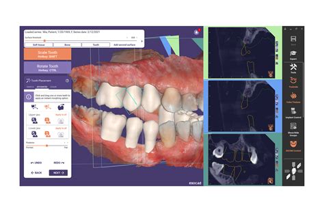 Exoplan Tutorial 的图像结果