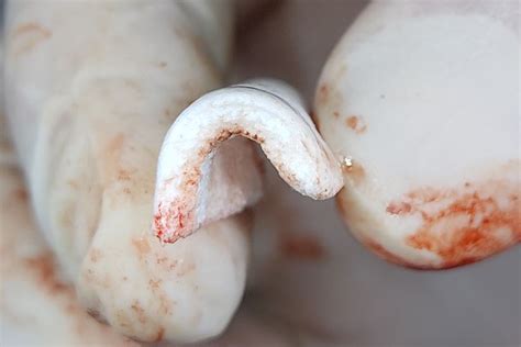 Image result for Flex Bone Matrix