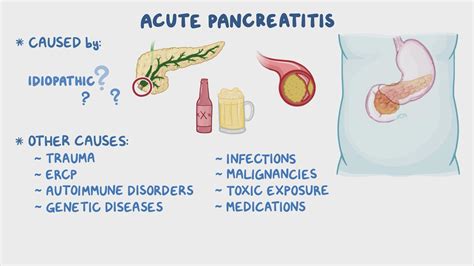 Acute pancreatitis: Clinical sciences - Osmosis Video Library