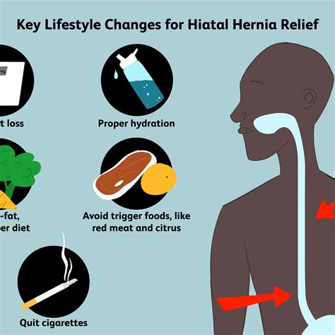 One Of The Best Tips About How To Live With Hiatal Hernia - Officermember29