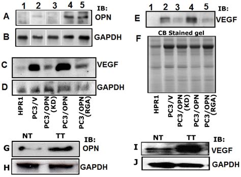 Osteopontin and MMP9: Associations with VEGF Expression/Secretion and ...