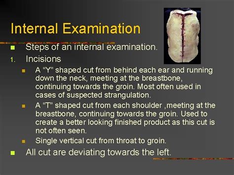 Image result for Compost Autopsy