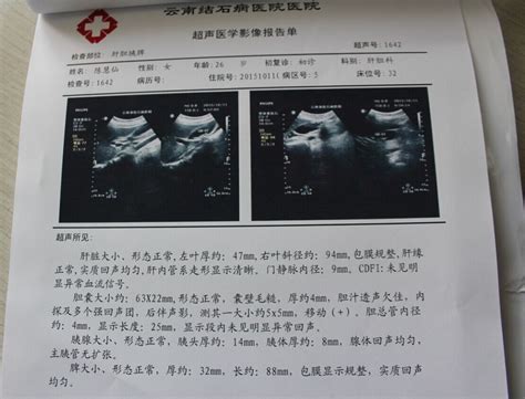 媳妇怀孕48天了，三次BC检查时间分别是4月4日，10日，19日（怀孕48天） 孩子发育健康吗？求解！！！ - 百度宝宝知道