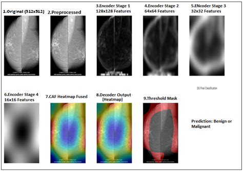 SwinCAMF-Net: Explainable Cross-Attention Multimodal Swin Network for ...