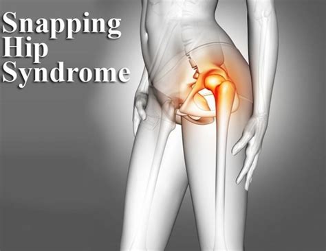 Snapping Hip Syndrome | Dr Nakul Shah