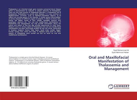 Buy Oral and Maxillofacial Manifestation of Thalassemia and Management ...