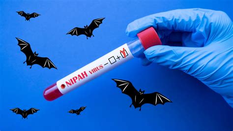Deadly Nipah virus outbreak: List of countries tightening airport ...