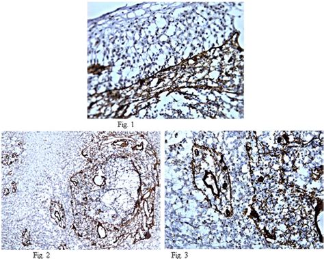 Anti-Heparan Sulfate Proteoglycan (Perlecan) Antibody, clone 5D7-2E4 ...