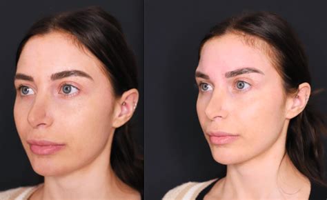 Image result for Contour Threads