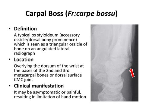 Radio-anatomy and Radio-pathology of hand and wrist.pdf