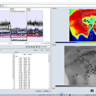 Image result for Split View Data. View