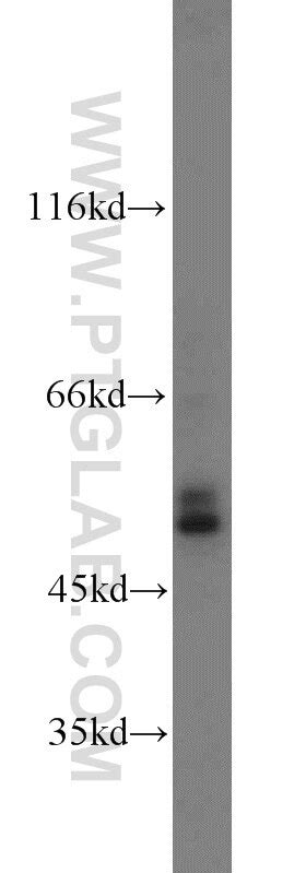 Glucagon antibody (15954-1-AP) | Proteintech