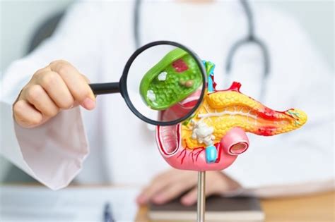 Kantong Empedu, Inilah Fungsi, Bagian, dan Gangguan yang Bisa Terjadi ...