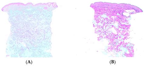 The Rheology and Physicochemical Characteristics of Hyaluronic Acid ...