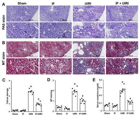 Intermittent Fasting Protects Against the Progression from Acute Kidney ...