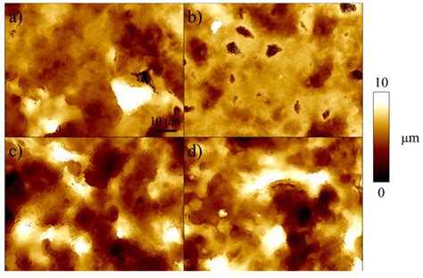 Raman Spectroscopic Investigation of Osteoclastic Activity under the ...