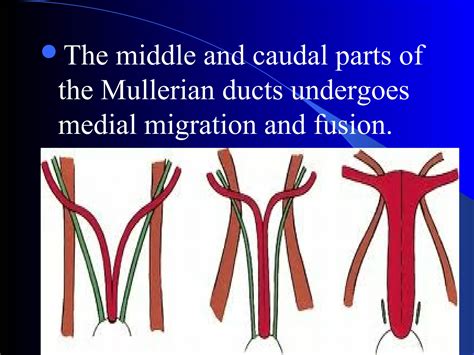 Embryology and congenital anomalies of female reproductive system for undergraduate | PPT