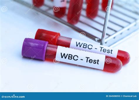 Purpose Of Wbc Lab Test at Eugene Linn blog