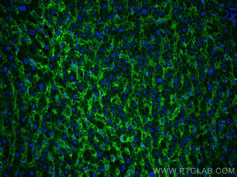 AQP9 antibody (20380-1-AP) | Proteintech