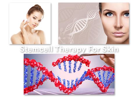 Stemcell Therapy for Skin Treatment in Chennai || Dr. Lavanya Skin ...