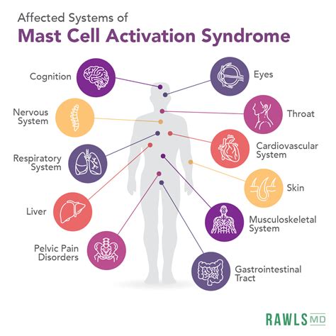 What Triggers Mast Cell Activation Syndrome