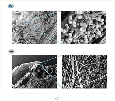 Are Hamstring Grafts a Predisposing Factor to Infection in R-ACL ...