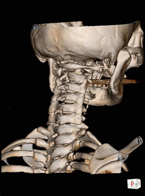 CT Scan cervical spine 3 D render . 15763271 Stock Photo at Vecteezy