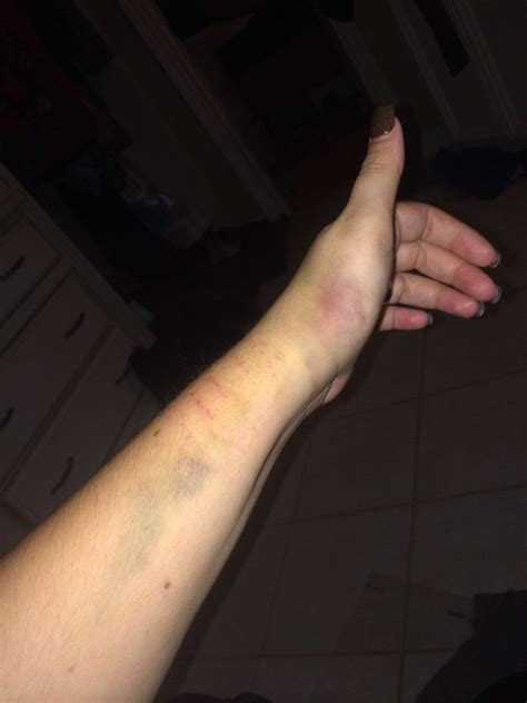 Retic Python Bite 的图像结果