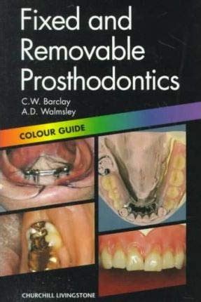 Buy Fixed and Removable Prosthodontics (Colour Guides) Book Online at ...