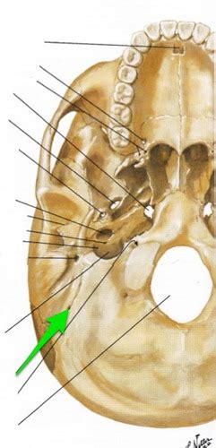 Image result for Temporal Bone Mastoid Process