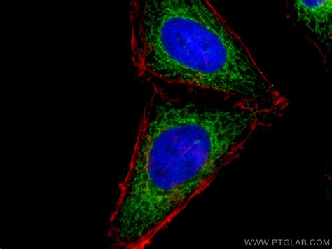 SLC25A1 antibody (15235-1-AP) | Proteintech