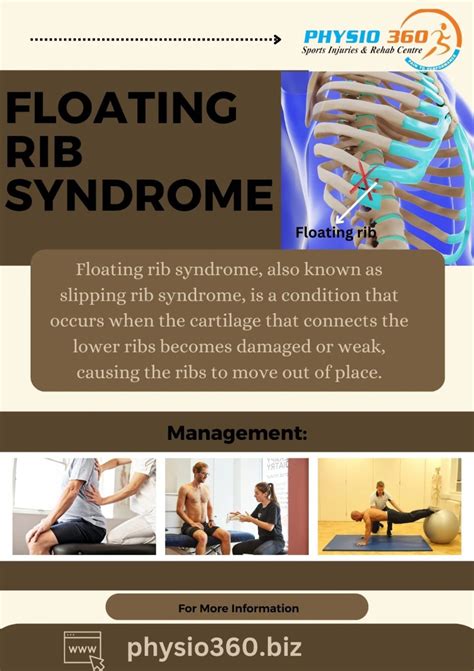 Floating Rib Syndrome also known as slipping rib syndrome, costal margin syndrome, or ...