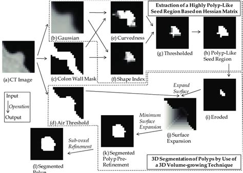Image result for Image Segmentation Algorithm