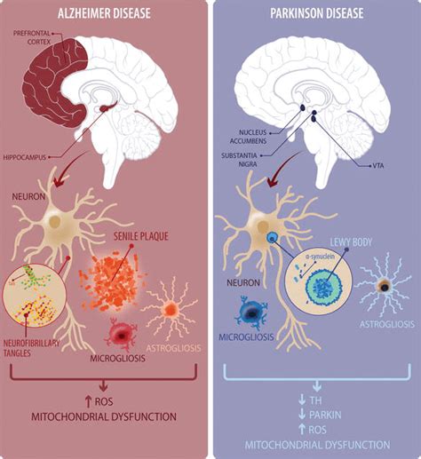 Ⅱ型神经纤维瘤病-肌骨经典与疑难病例磁共振诊断图谱-医学