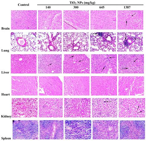 Image result for Different Tissues Under Microscope