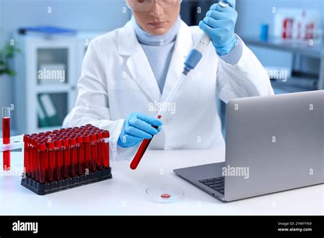 Image result for D Sample Testing in Doctor Lab