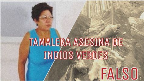 Image result for Temporal SpO2 Probe