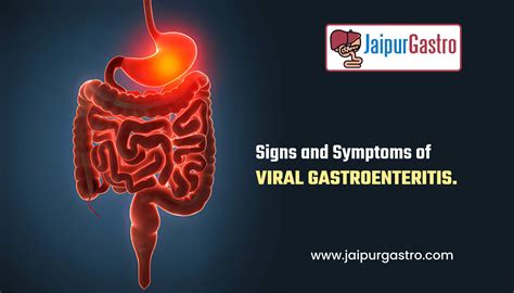 Signs and Symptoms of Viral gastroenteritis - Jaipur Gastro Clinic