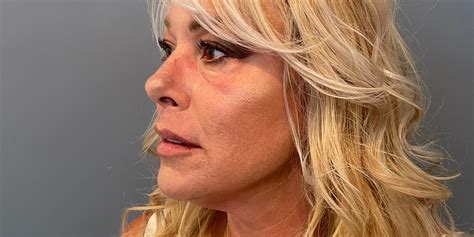 Image result for Cheek Threading