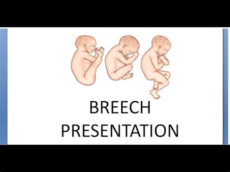 Image result for How to Implement Linear Regression in Python