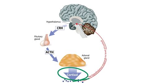 What Causes High Cortisol?