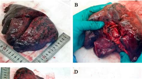 新冠肺炎最早发现城市新冠肺炎最先发现者2022已更新今日资讯