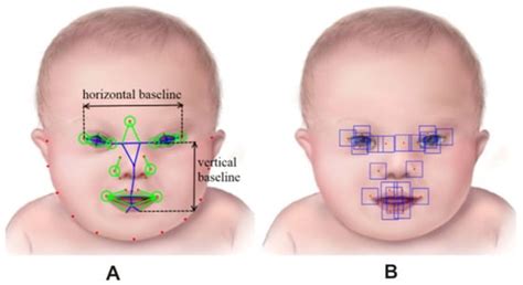 Down Syndrome Face Recognition: A Review