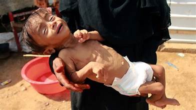 Starving child in Gaza