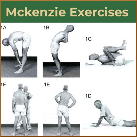 McKenzie Exercises - Sports Medicine Review