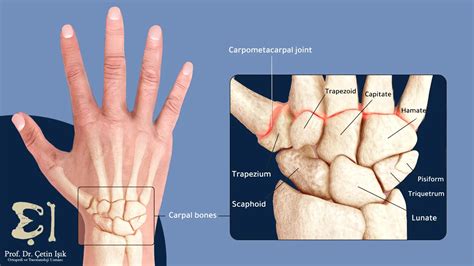 protrusion of the wrist bone; Is it a serious problem? - Dr. What's wrong with you?